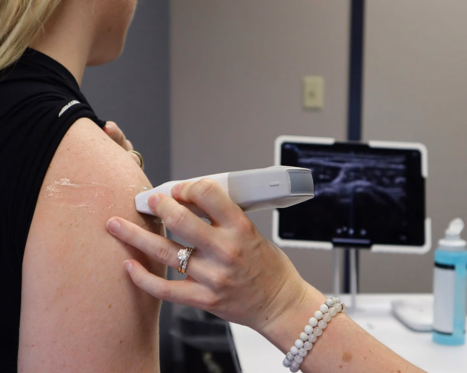Sonographiegestützte Untersuchung mit Ultraschallgerät am Standort BIONIK Düsseldorf-Oberkassel